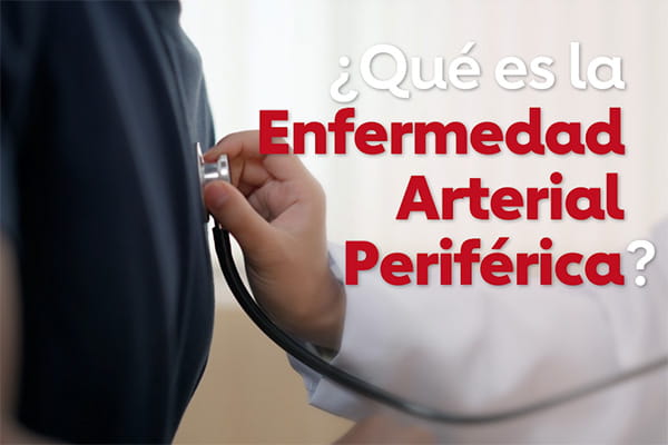 ¿Qué es la enfermedad arterial periférica? video screenshot
