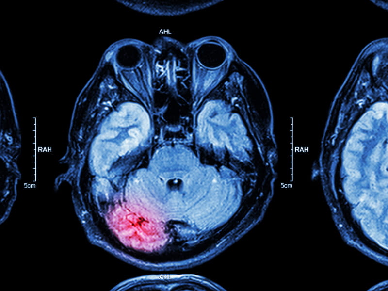 stockdevil, iStock/Getty Images Plus, Getty Images