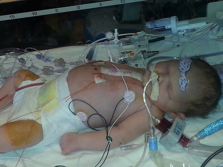 Alyiah was born in 2013 with several heart defects and had open-heart surgery days after her birth