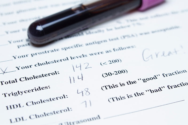 a close-up view of a document showing an example of someone's cholesterol numbers