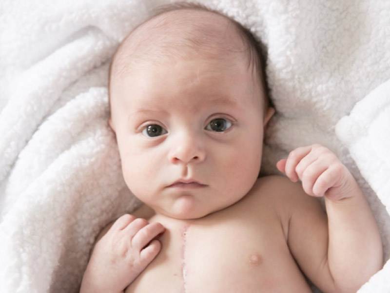 Congenital heart defect survivor Luke Pilkinton. (Photo courtesy of Bright Heart Foundation)