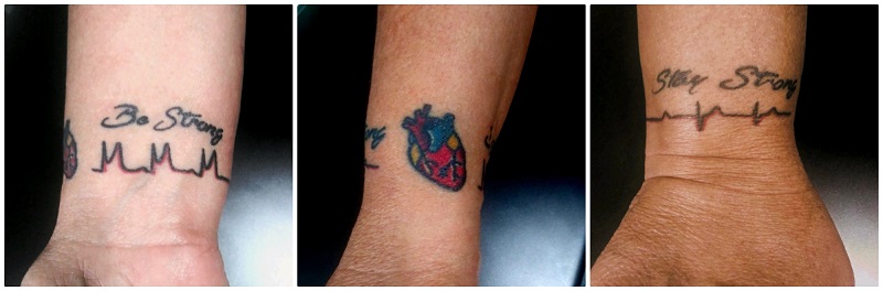 A tattoo on heart attack survivor Barbara Marquez's wrist reminds her to be strong and stay strong. (Photo courtesy of Barbara Marquez)