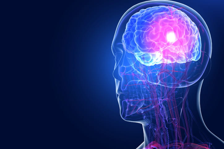 brain hemorrhagic picture